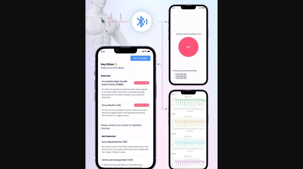 Syncardia AI ECG App